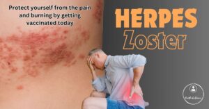 herpes zoster vaccine